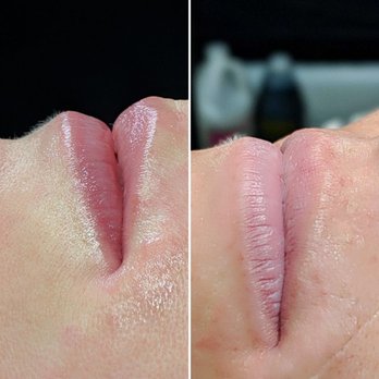 Dermaplume Studio - Adding a light pink natural color to these lips. - Permanent Makeup Near Me - Takoma Park, Maryland Dermaplume Studio - Adding a light pink natural color to these lips. - Permanent Makeup Near Me - Takoma Park, Maryland