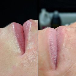 Dermaplume Studio - Adding a light pink natural color to these lips.