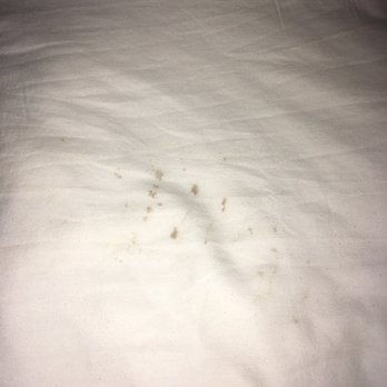 Massage Magic - Blood stained sheets - Massage Therapy Near Me - Portland, Oregon Massage Magic - Blood stained sheets - Massage Therapy Near Me - Portland, Oregon