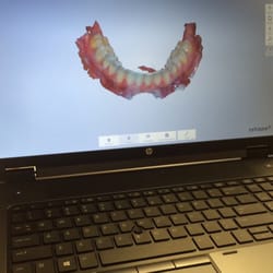 Jay Wygodny - We now take impressions digitally. No more goop!