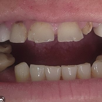 Smile Line Dentistry - General Dentistry Near Me - Antioch, California Smile Line Dentistry - General Dentistry Near Me - Antioch, California