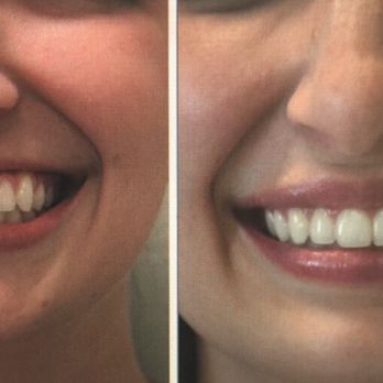 Weiler Plastic Surgery - Laser Hair Removal Near Me - Baton Rouge, Louisiana