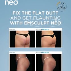 Fleur De Lis Aesthetics - See what EMSCULPT NEO can do for you