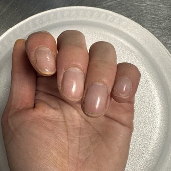 American Nail Spa - My nails from this salon within two days. Looks terrible ! Chipping and the cuticles are scaly and dry! - Nail Salons Near Me - Chicago, Illinois American Nail Spa - My nails from this salon within two days. Looks terrible ! Chipping and the cuticles are scaly and dry! - Nail Salons Near Me - Chicago, Illinois