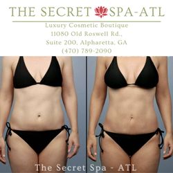 BEFORE & AFTER
Our clients wanted to lose weight without the pain, hassle of taking off work, or simply just a lot of down time.