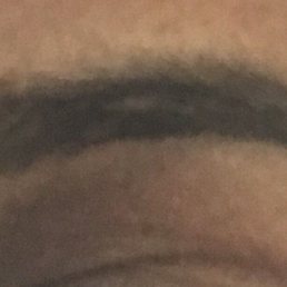 Right eye Right eye