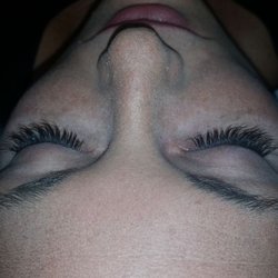 Black Diamond Skincare - After