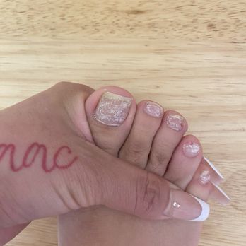 J's Nails and Spa - Damaged toe nails after 3 weeks - Nail Salons Near Me - Vista, California