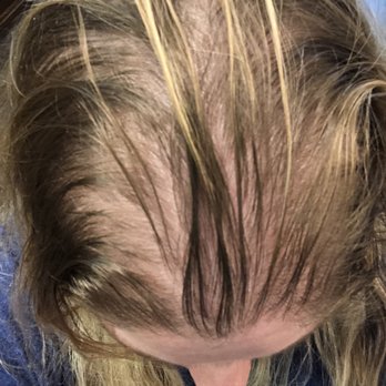 Gia's Salon - My before picture. Dark, greasy, thinned and so very Wrong looking. - Hair Stylists Near Me - Brighton, Michigan