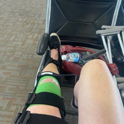 OrthoVirginia - The knee in question- doing better now!