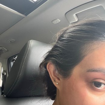 Arc Beauty Salon - My face felt like it had been sandpapered. Much more severe than a typical face waxing - Waxing Near Me - Fair Lawn, New Jersey Arc Beauty Salon - My face felt like it had been sandpapered. Much more severe than a typical face waxing - Waxing Near Me - Fair Lawn, New Jersey