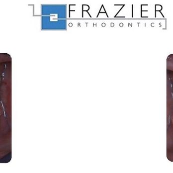 Frazier Orthodontics - Orthodontists Near Me - River Forest, Illinois