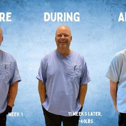 Svelte Medical Weight Loss Centers - Dr. Bragg's personal GLP-1 transformation