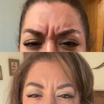 Innovative MedSpa - Lincoln Park - February 2020 vs November 2020 - Medical Spas Near Me - Chicago, Illinois Innovative MedSpa - Lincoln Park - February 2020 vs November 2020 - Medical Spas Near Me - Chicago, Illinois