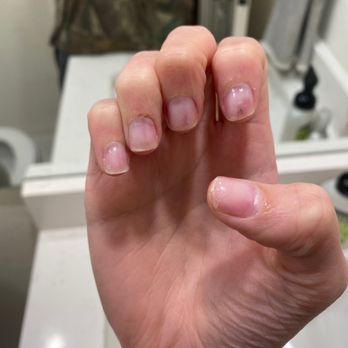 Cedar Park Nails - Acrylic nails removed with a cut on my wedding ring finger. - Nail Salons Near Me - Cedar Park, Texas