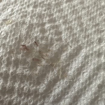 The Nail Essence - This is all the nasty cuticle I had to remove at home. A service I pay for. - Nail Salons Near Me - Staten Island, New York The Nail Essence - This is all the nasty cuticle I had to remove at home. A service I pay for. - Nail Salons Near Me - Staten Island, New York