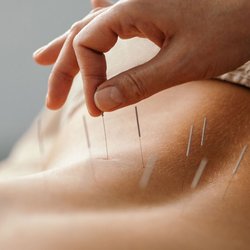 Advance Healing Clinic