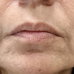 Gulf Coast Facial Plastics and ENT Center - Before