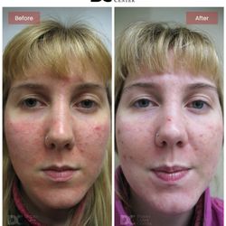 Derma Laser Centers