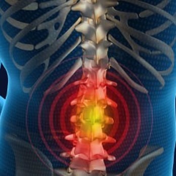 Cecil Chiropractic Clinic - Extreme back pain is debilitating. We can help! - Chiropractors Near Me - Countryside, Illinois Cecil Chiropractic Clinic - Extreme back pain is debilitating. We can help! - Chiropractors Near Me - Countryside, Illinois