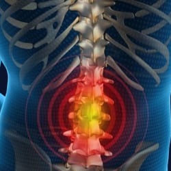 Cecil Chiropractic Clinic - Extreme back pain is debilitating. We can help!