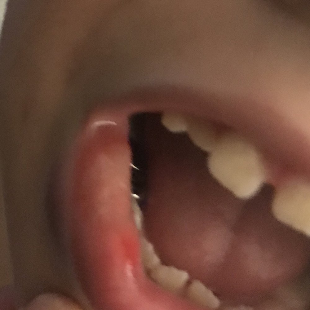 Apex Dental - General Dentistry Near Me - Nacogdoches, Texas