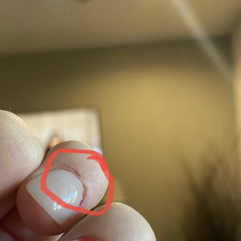 AZ Admire Nails & Spa - Cute my cuticles until they bled - now starting to scab in pic - Waxing Near Me - Chandler, Arizona