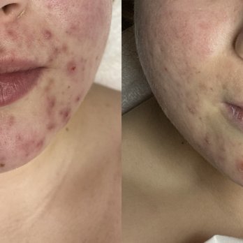 Advanced Skin Care Center - Medical Spas Near Me - Encino, California