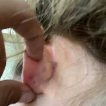 Lulu Ave - Indent from earring - Piercing Near Me - Long Beach, California Lulu Ave - Indent from earring - Piercing Near Me - Long Beach, California