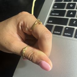 Extremely red cuticles and look at this thick nail...