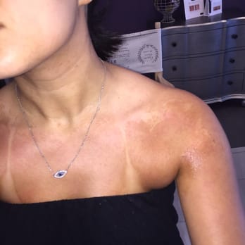 Quiet Beauty Spa - This is just a few hours after the spray tan, it looked even worse the next day - Eyelash Service Near Me - Newport Beach, California Quiet Beauty Spa - This is just a few hours after the spray tan, it looked even worse the next day - Eyelash Service Near Me - Newport Beach, California