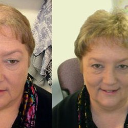 Just Hair Clinic