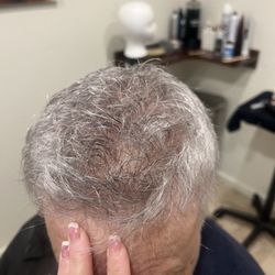 Hair Replacement Associates - Skin systems ...Amazing results