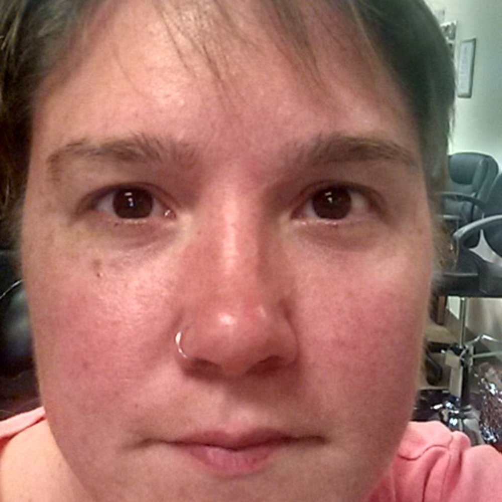 Threading by Nadia - Before. Catepillers on my forehead. - Threading Services Near Me - Miramar, Florida Threading by Nadia - Before. Catepillers on my forehead. - Threading Services Near Me - Miramar, Florida