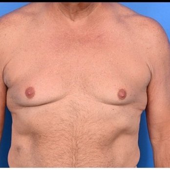 Westlake Plastic Surgery - Preop - Cosmetic Surgeons Near Me - Austin, Texas Westlake Plastic Surgery - Preop - Cosmetic Surgeons Near Me - Austin, Texas