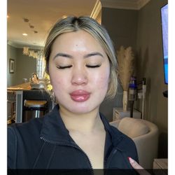 The Facebar Aesthetic Medicine - Current skin