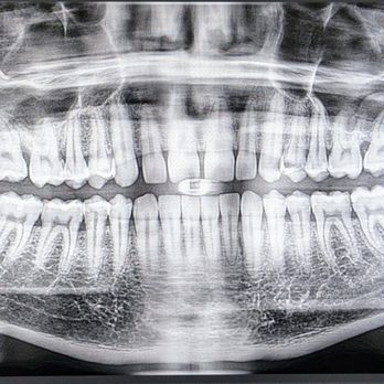 Paramount Dental and Braces - General Dentistry Near Me - Paramount, California Paramount Dental and Braces - General Dentistry Near Me - Paramount, California