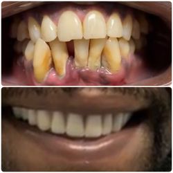 Atlantis Dental - Before and after transformation
