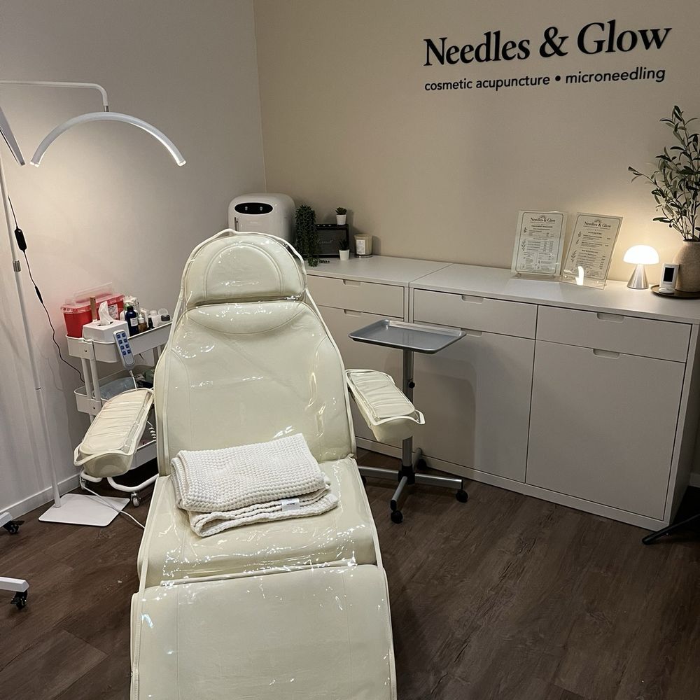 Needles & Glow - Acupuncture Near Me - Pasadena, California