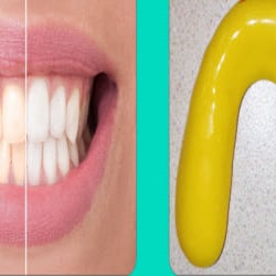 Paterno Orthodontics - Philips Zoom Teeth Whitening