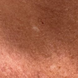 Laser Remedy Skin Solutions