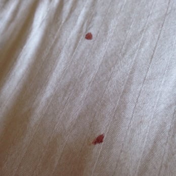 Coast International Inn - Blood on sheets on bed - Hotels Near Me - Anchorage, Alaska Coast International Inn - Blood on sheets on bed - Hotels Near Me - Anchorage, Alaska