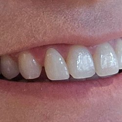 Petrides Family Dentistry - Look at the difference!