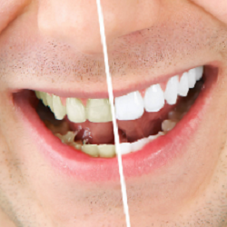 Chino Hills Dental Office - Chino Hills, CA Family Dentist