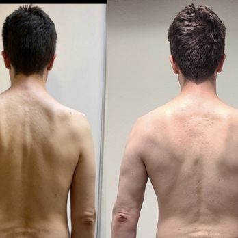 Downright Fit - Left=before & Right is after about 9 months incl. working thru a shoulder injury. More muscle mass & definition. Can actually see triceps! - Trainers Near Me - Campbell, California