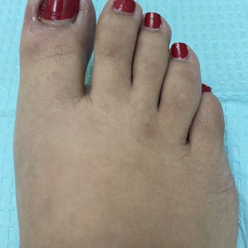 Gabriel J Halperin D.P.M. - Right foot/toe...OUCH! - Podiatrists Near Me - Los Angeles, California Gabriel J Halperin D.P.M. - Right foot/toe...OUCH! - Podiatrists Near Me - Los Angeles, California