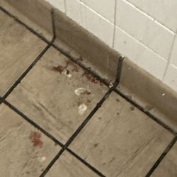 KFC - Blood in the restroom