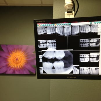 J Scott Shepherd, DMD - Palm Springs Family & Cosmetic Dentistry - X-rays - Cosmetic Dentists Near Me - Palm Springs, California J Scott Shepherd, DMD - Palm Springs Family & Cosmetic Dentistry - X-rays - Cosmetic Dentists Near Me - Palm Springs, California