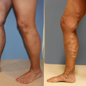 Thomae Surgical - Cosmetic Surgeons Near Me - Florissant, Missouri Thomae Surgical - Cosmetic Surgeons Near Me - Florissant, Missouri