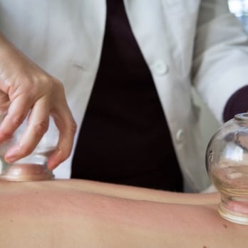 Acupuncture Mama - Acupuncture Near Me - Santa Rosa, California